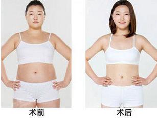 我想问一下全身吸脂后多长时间能够要小孩子？