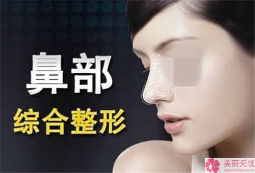 推行假体垫鼻子最后价格高吗