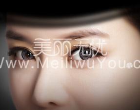 双眼皮手术有年龄限止吗？求出!