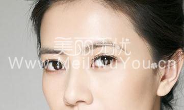 普遍的眼部整形手术中的六个小误区