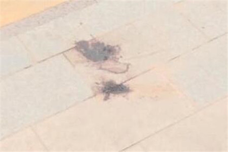 少女流产拒绝就医，流产的征兆有哪些