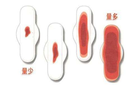女人月经量多怎么回事，离不开4种原因