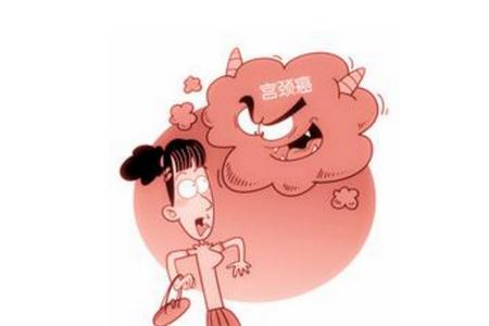 宫颈癌早期常见的两个症状