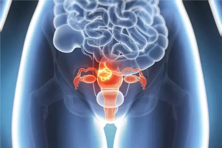 女人多囊卵巢能怀孕吗