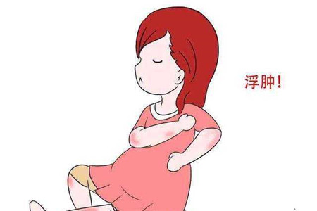 怀孕期出现水肿的原因以及缓解方法